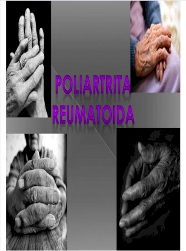 artrita reumatoida pdf